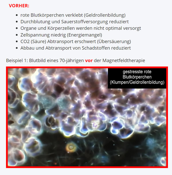 Blut vor Magnetfeldtherapie in  Wülfrath